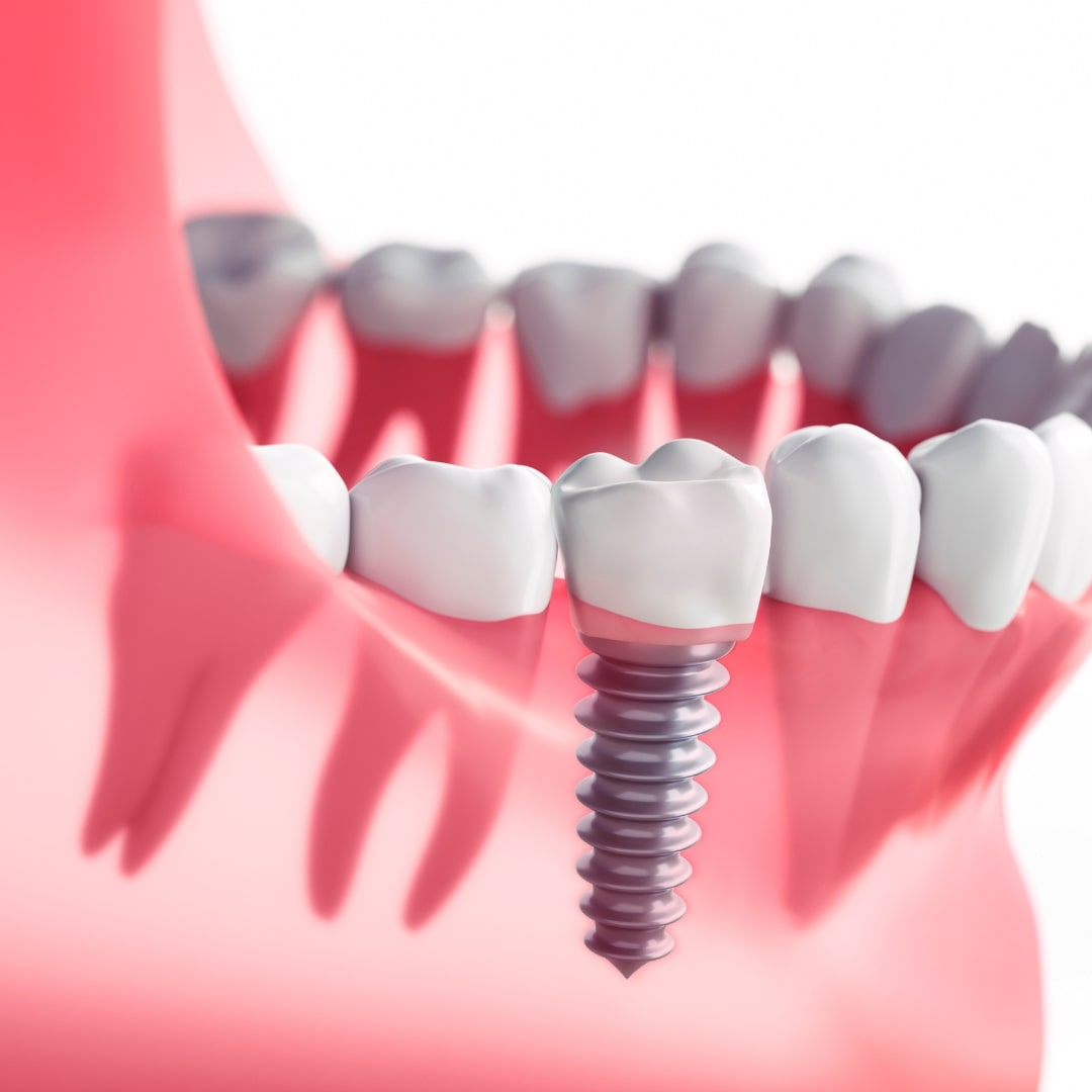 Leading Dental Clinic In Bhubaneswar – Abcd Clinic For Comprehensive Care"